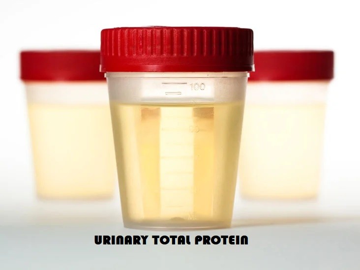 Urinary Total Protein 1329